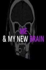 Watch Me & My New Brain Fmovies