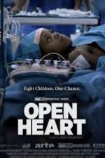 Watch Open Heart Fmovies