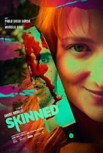 Watch Skinned Fmovies