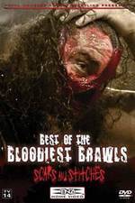 Watch TNA Wrestling: Best of the Bloodiest Brawls - Scars and Stitches Fmovies