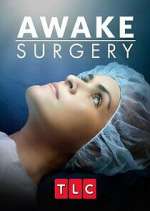 Watch Awake Surgery Fmovies